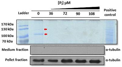 Mobilization and Cellular Distribution of Phosphate in the Diatom Phaeodactylum tricornutum